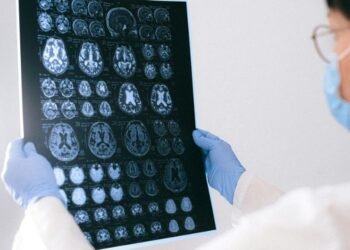 Anoxic Brain Injury Bee Sting: Protect Your Rights Now