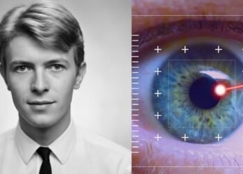 David Bowie Before Eye Injury