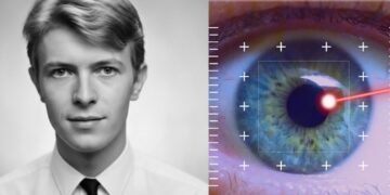 David Bowie Before Eye Injury