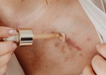 Khloé Kardashian Skin Cancer Lawsuit